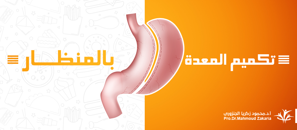 ماهو سعر عملية تكميم المعدة بالمنظار|بالتقسيط 2020