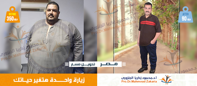 سعر تحويل مسار المعدة بالمنظار 2020(أقل سعر)